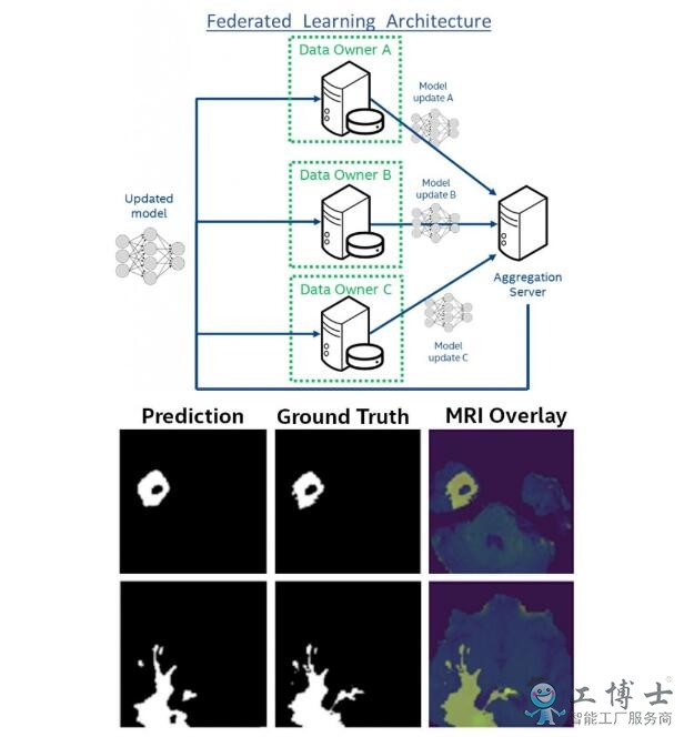 人工智能在未来可以帮助识别脑瘤